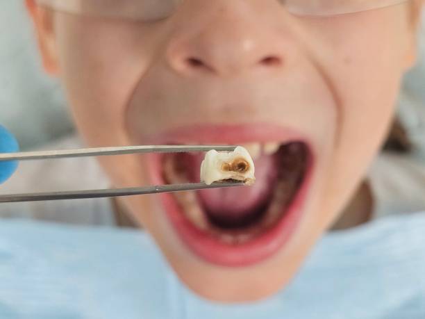 Best Weekend Emergency Dentist in Forks, WA