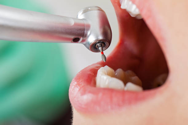 Best Orthodontic Emergency Dentist in Forks, WA